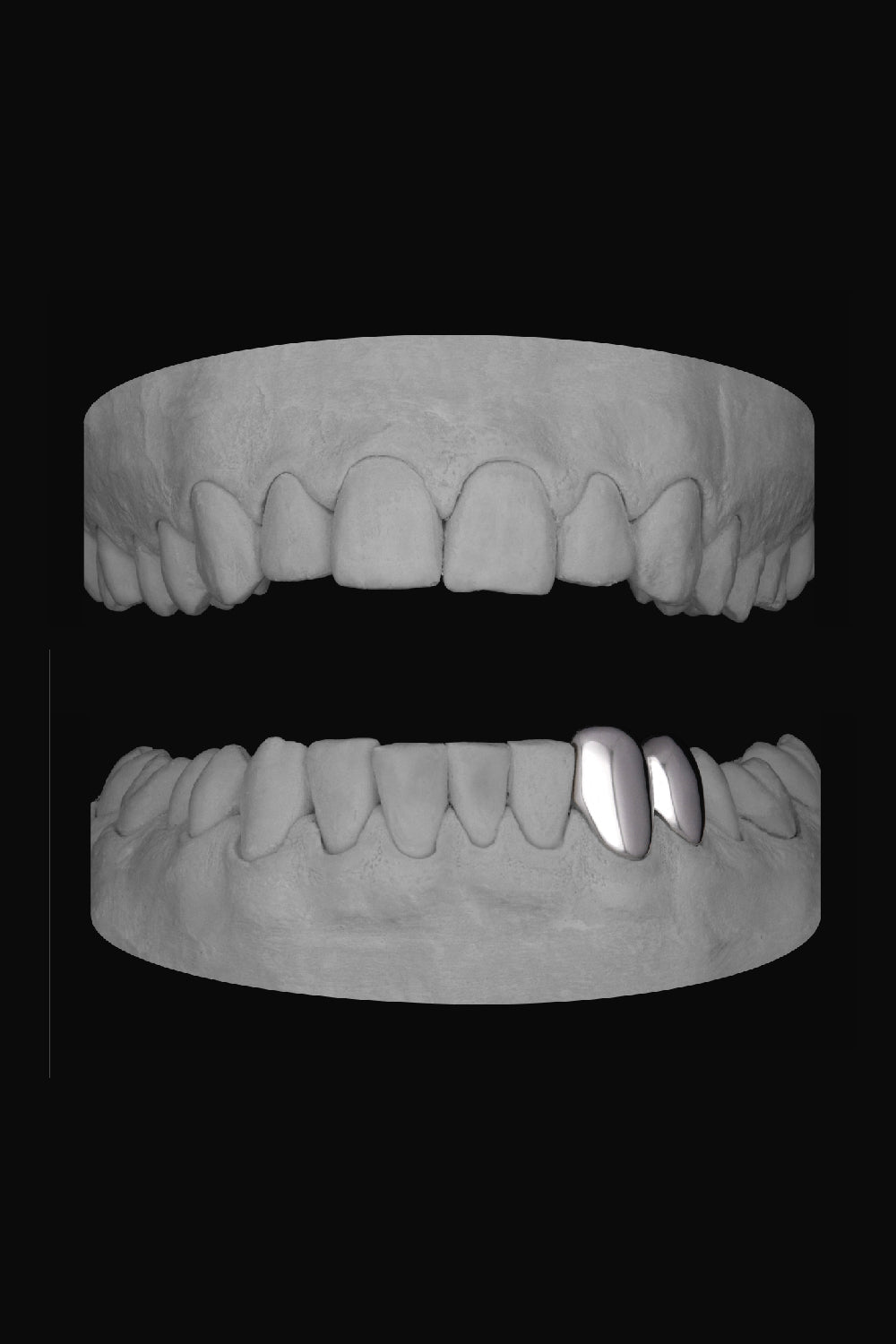 Canine & Premolar (Lower)