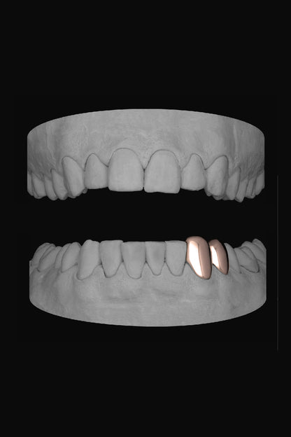 Canine & Premolar (Lower)