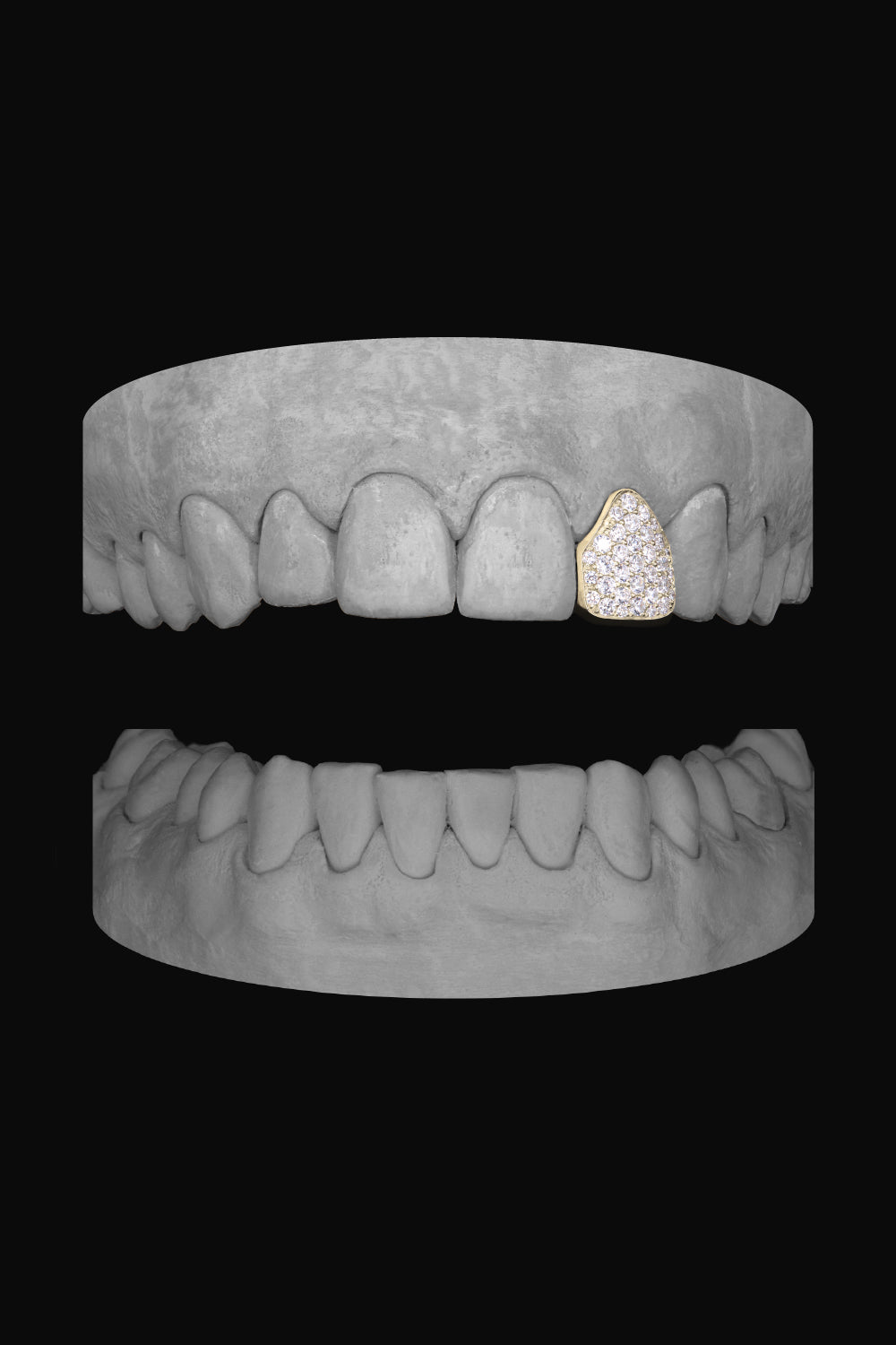 Diamond Lateral