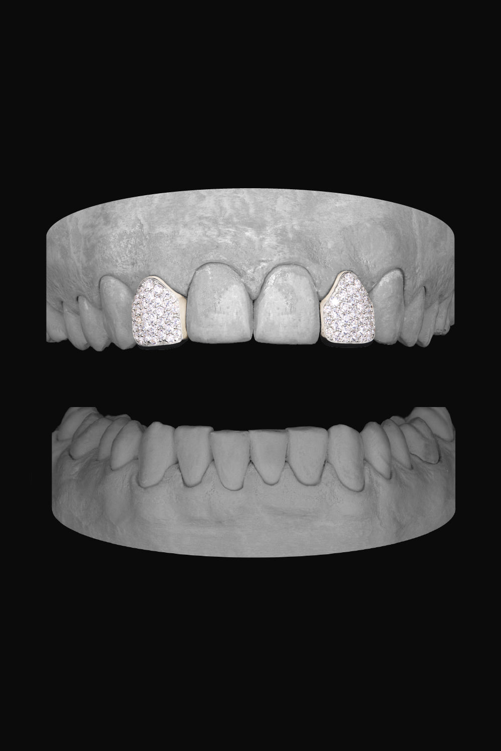 Diamond Lateral - Lateral
