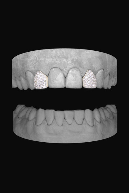 Diamond Lateral - Lateral