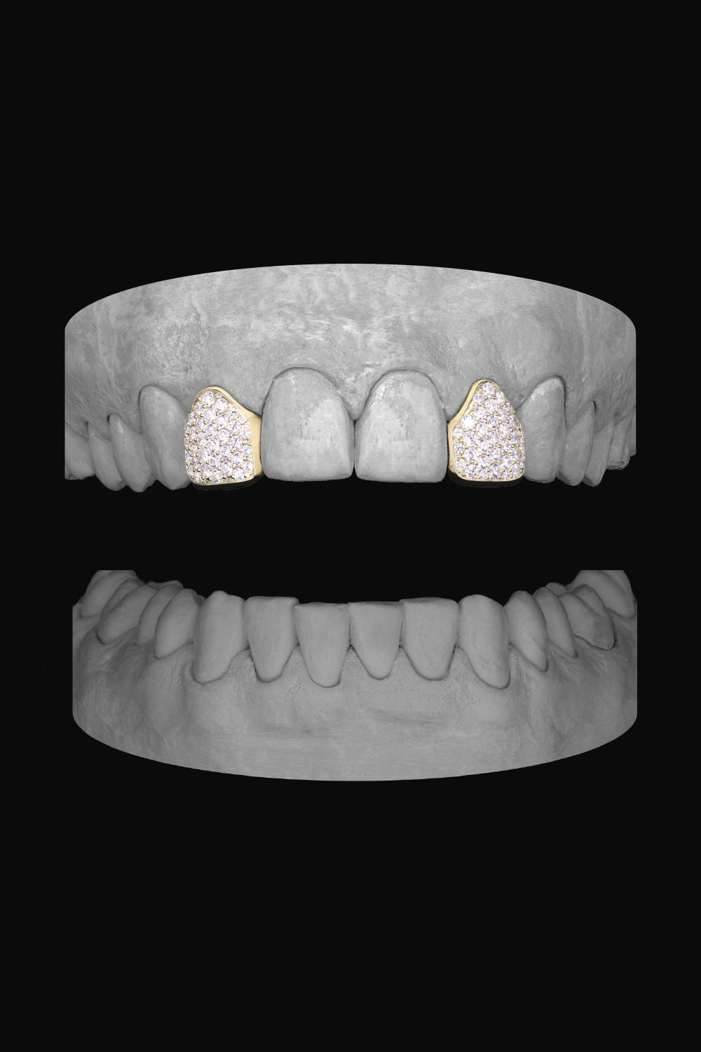 Diamond Lateral - Lateral