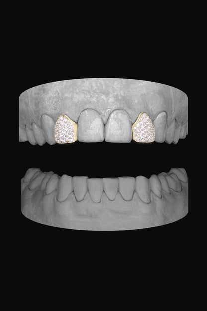 Diamond Lateral - Lateral