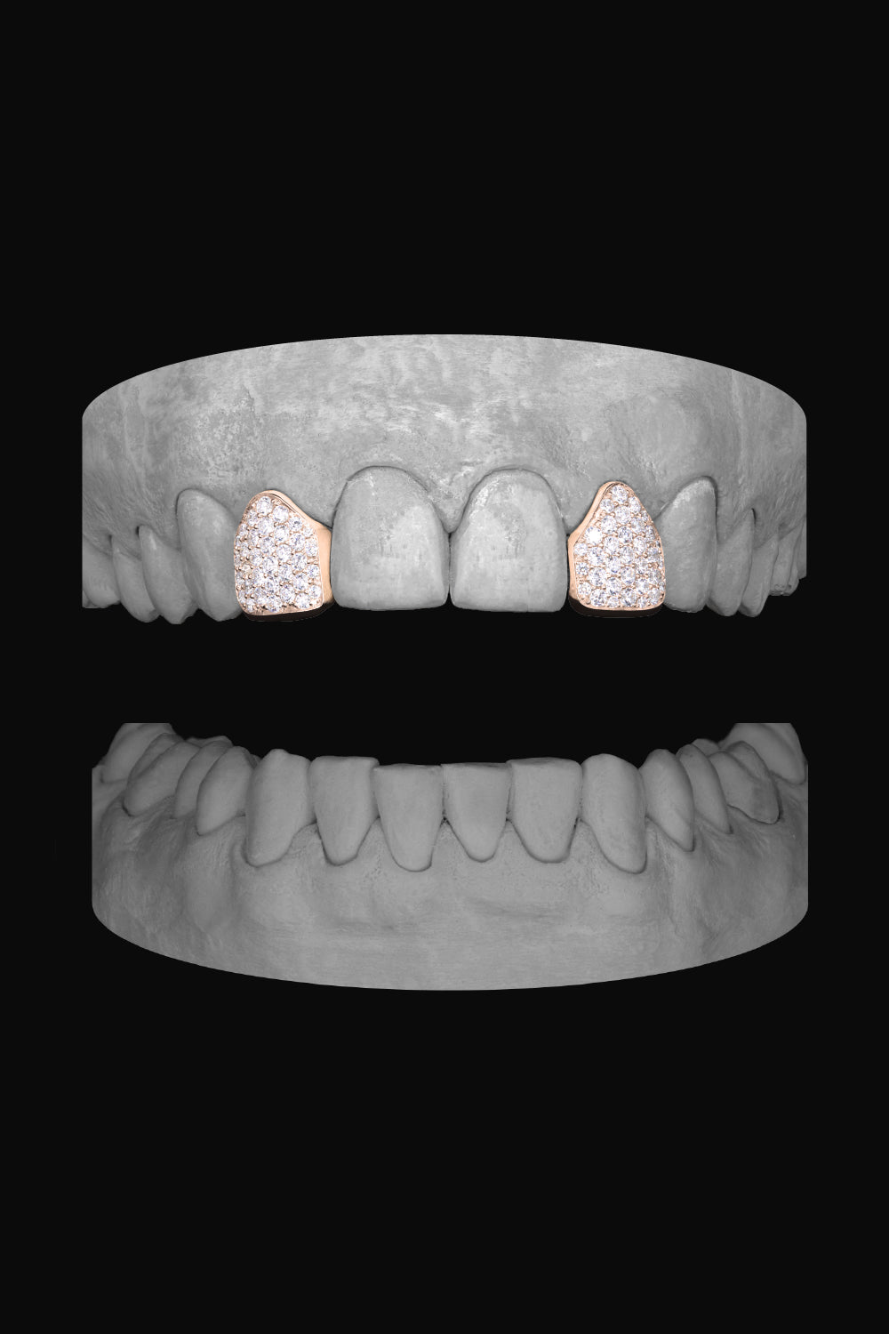 Diamond Lateral - Lateral