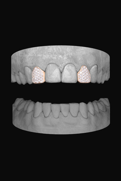 Diamond Lateral - Lateral