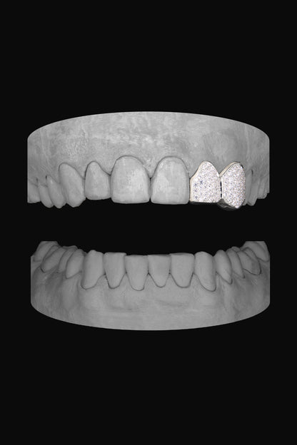 Diamond Lateral & Canine