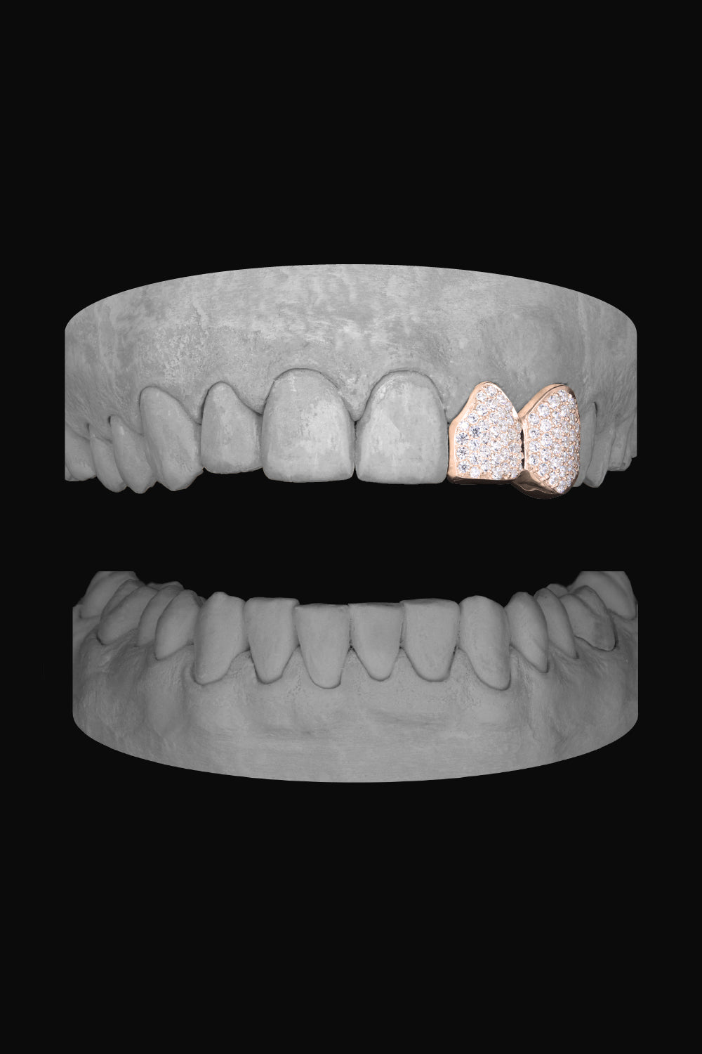 Diamond Lateral & Canine