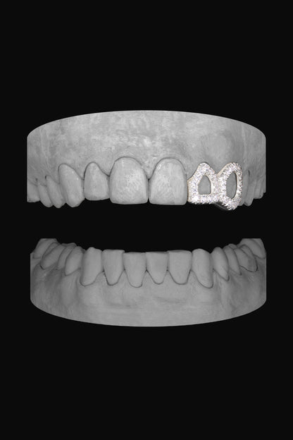 Diamond Window Lateral & Canine