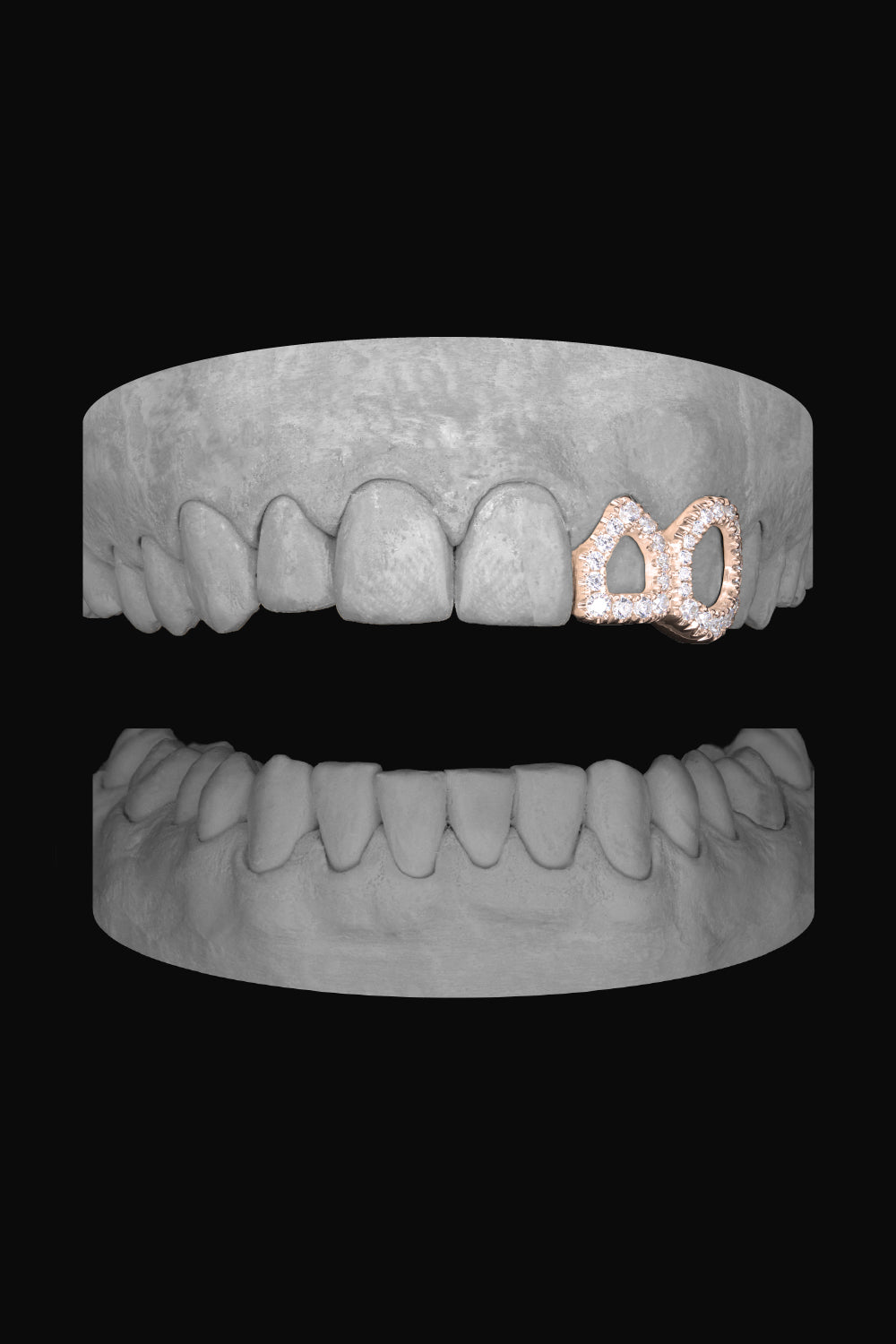 Diamond Window Lateral & Canine