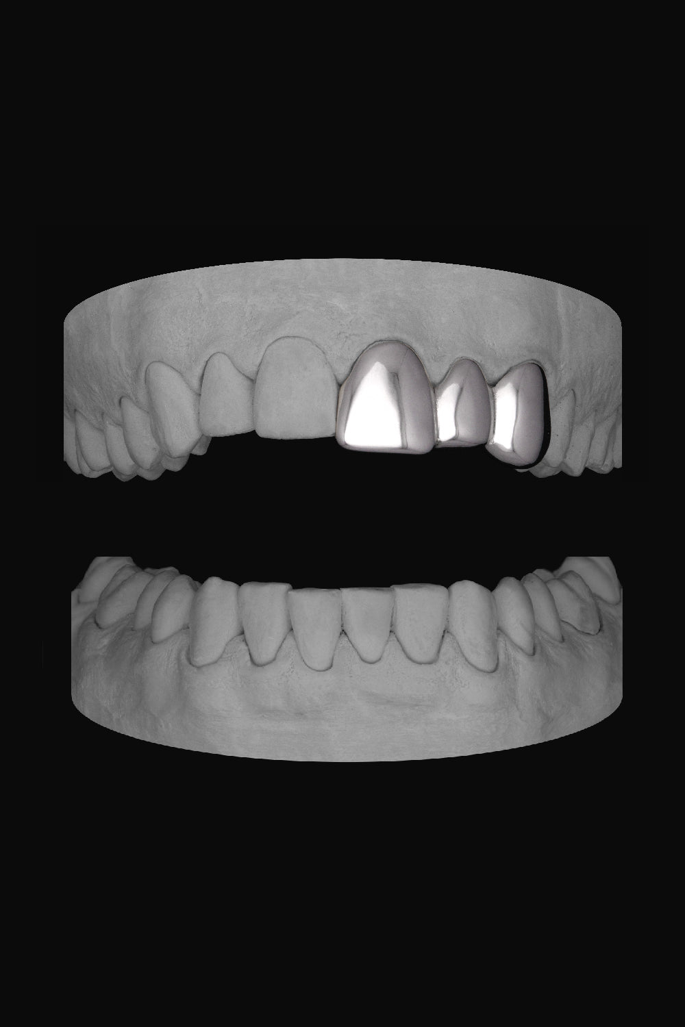 Front & Lateral & Canine