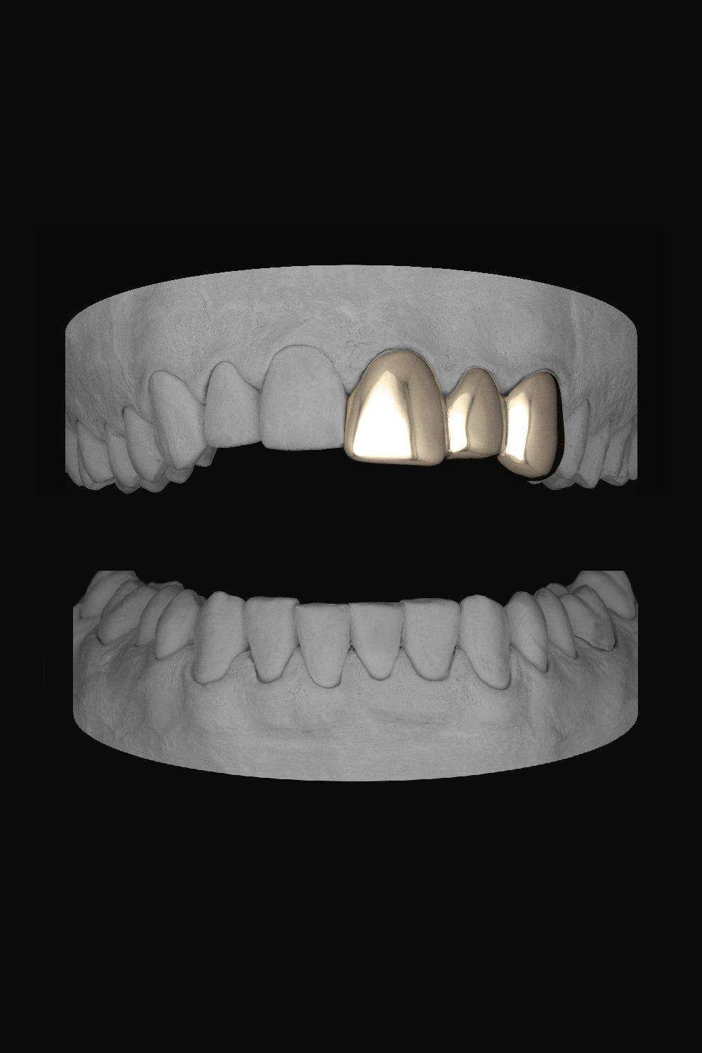 Front & Lateral & Canine