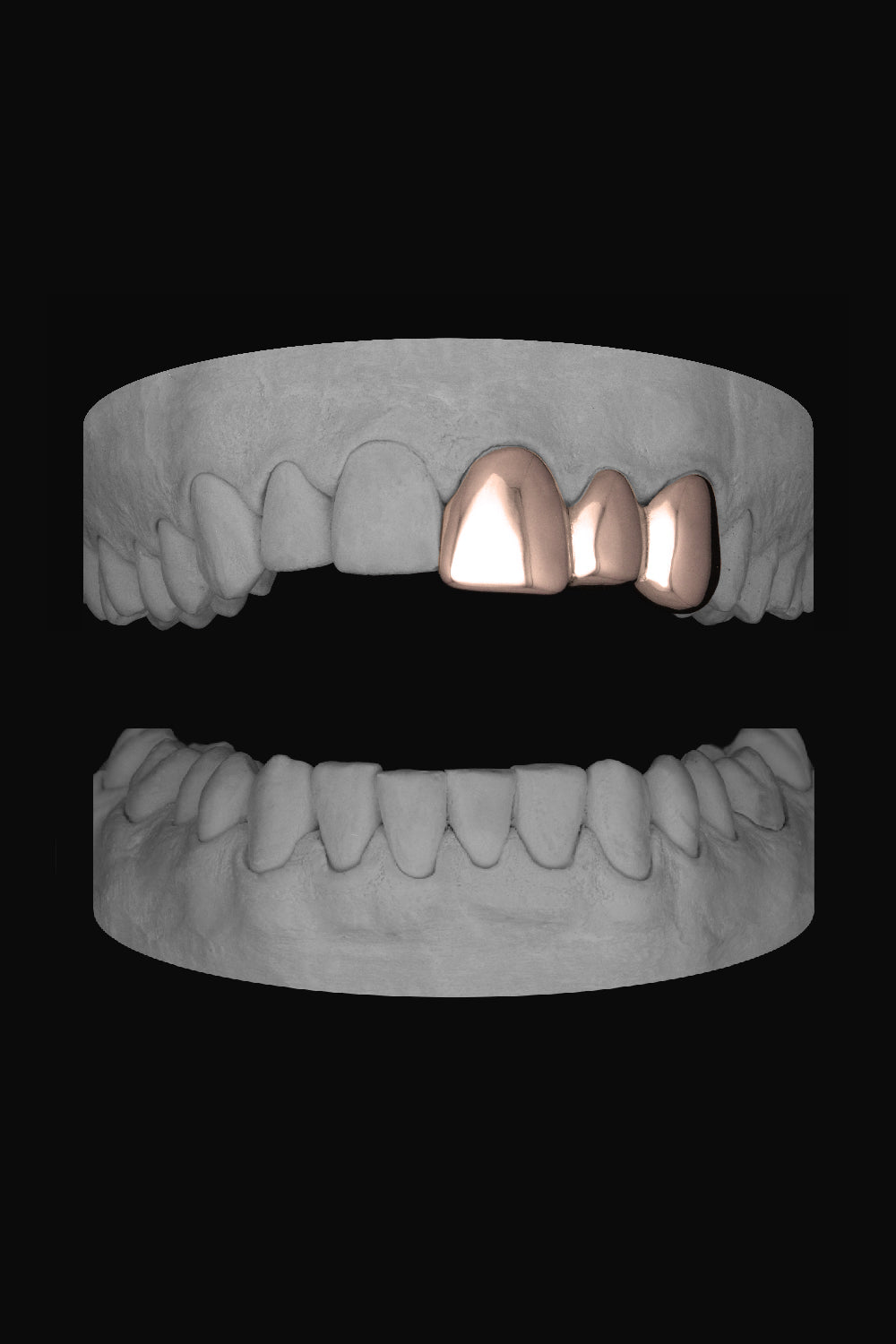 Front & Lateral & Canine