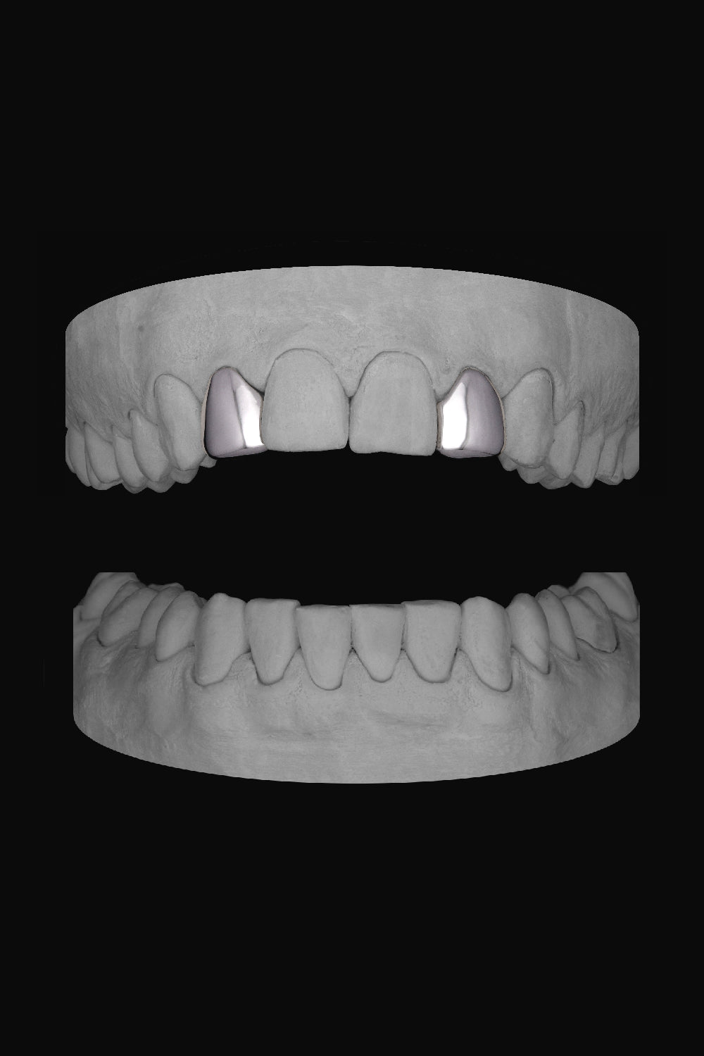 Lateral - Lateral
