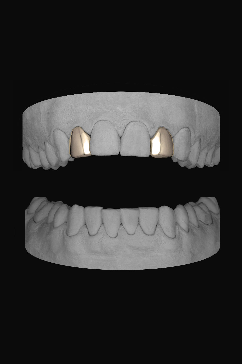 Lateral - Lateral