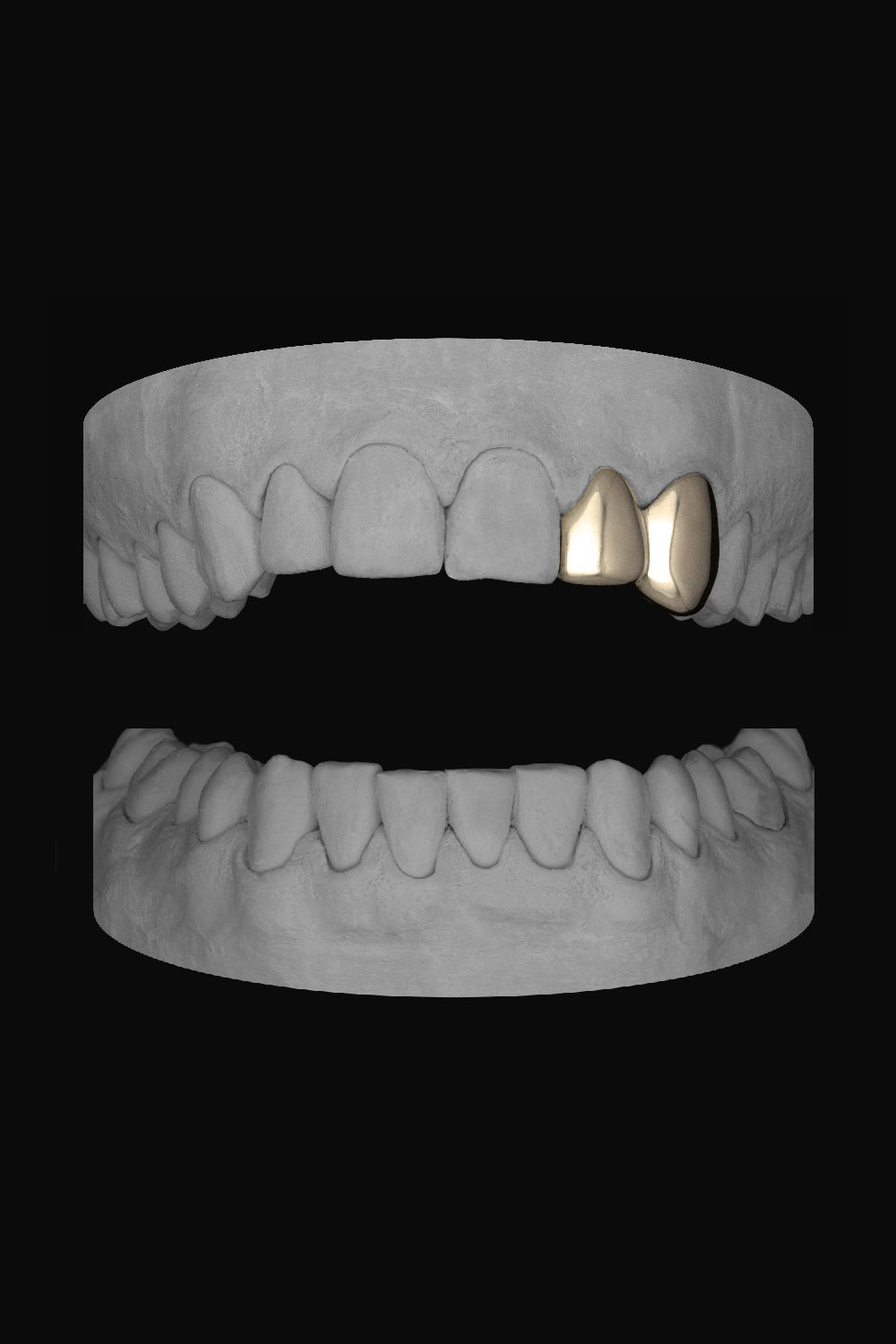 Lateral & Canine