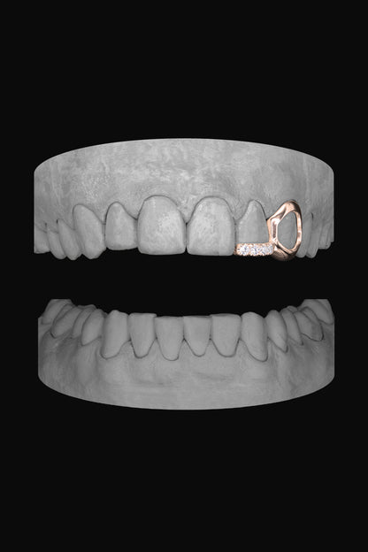 Window Canine & Diamond Bar