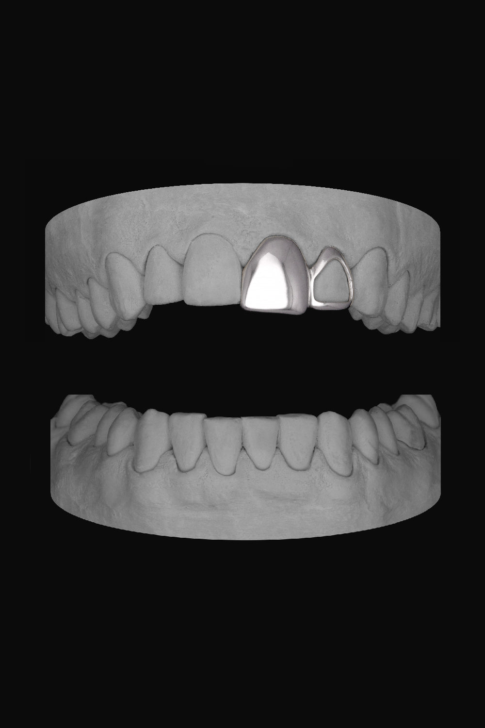 Window Lateral & Front