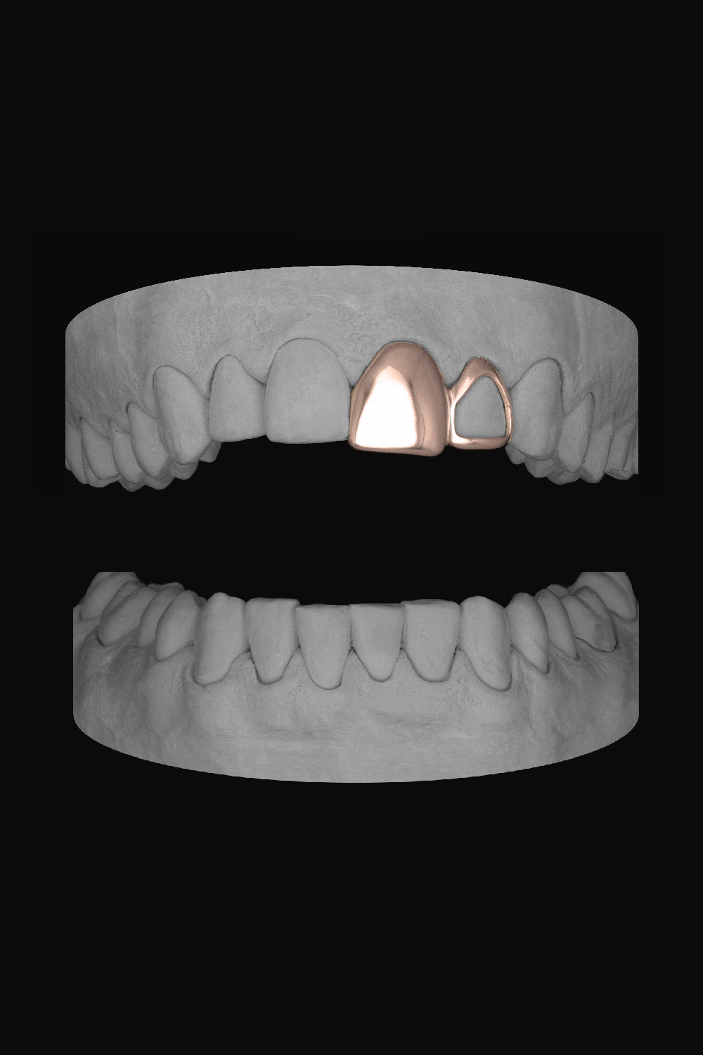 Window Lateral & Front