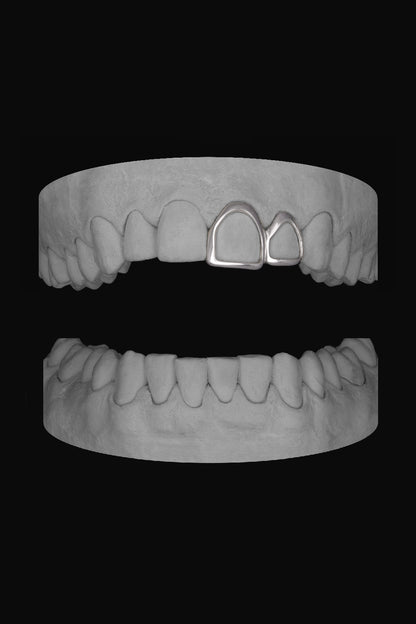 Window Lateral & Window Front